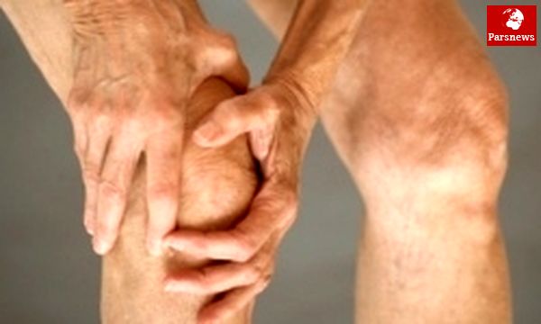 هر ۵ کیلو کاهش وزن، ۲۰ درصد پیشرفت آرتروز را کم میکند