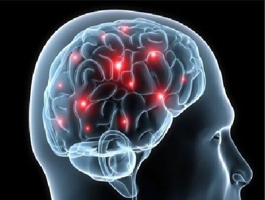 هنگام بروز سکته مغزی چه باید کرد؟