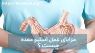 مزایای اسلیو معده چیست ؟