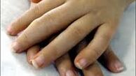 چرا انگشتان دست ورم می کند؟