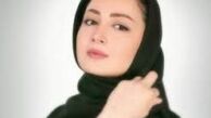 لبخند مصنوعی شیلا خداداد/عکس
