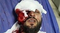 پزشکی قانونی نابینایی کامل چشم فروزش را تأیید کرد