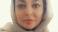 چهره تغییر کرده رزیتا غفاری + عکس