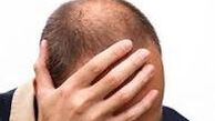 جلوگیری از ریزش مو با این ماساژ