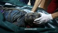 تصاویر هولناکی از کشتار بی‌رحمانه کودکان فلسطینی/چقدر بدم مي آيد از  سازمان ملل و شوراي امنيت