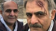 عکس آقای بازیگر با سر شکسته