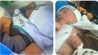 شکستگی بازوی نوزاد اصفهانی در حین عمل زایمان +عکس