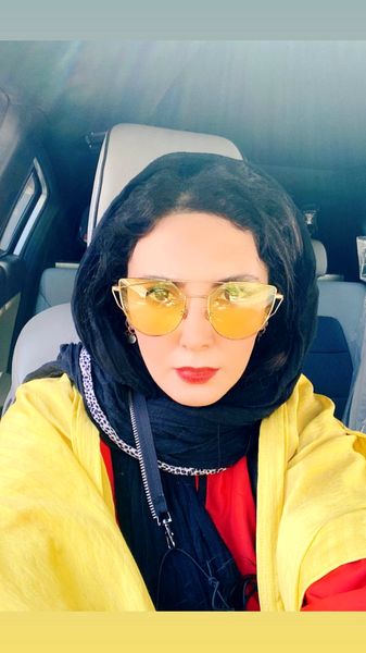 تیپ زرد خانم بازیگر مشهور + عکس