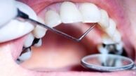  پرداخت ماهیانه ۱۷ هزار تومان برای بیمه دندانپزشکی