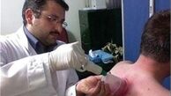 اثرات درمانی حجامت در درمان بیماری‌ها 