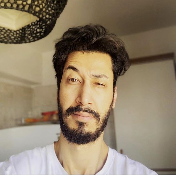 چهره به هم ریخته بهرام افشاری + عکس