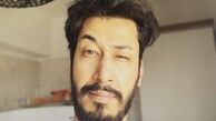 چهره به هم ریخته بهرام افشاری + عکس