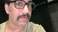 محمد نادری با قیافه ای شلخته + عکس