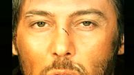 صورت زخمی‌دانیال عبادی + عکس