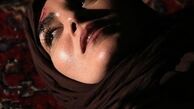زخمی شدن سر بازیگر معروف + عکس