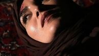 زخمی شدن سر بازیگر معروف + عکس