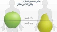 شما جزو کدام یک نوع چاقی هستید؟ + راه‌حل