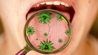 کرونا باعث زخم دهان و لثه ها می شود ؟