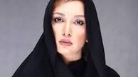 چهره نصفه و نیمه روناک یونسی /عکس
