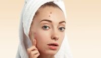 بهترین ترفند تخلیه جوش صورت بدون زخم و آسیب