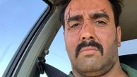 صورت زخمی و خونی پوریا پورسرخ + عکس