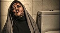 صورت پر از خون ‌خانم بازیگر + عکس