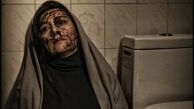 صورت پر از خون ‌خانم بازیگر + عکس