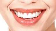 آیا جنس دندان به ژنتیک مرتبط است؟