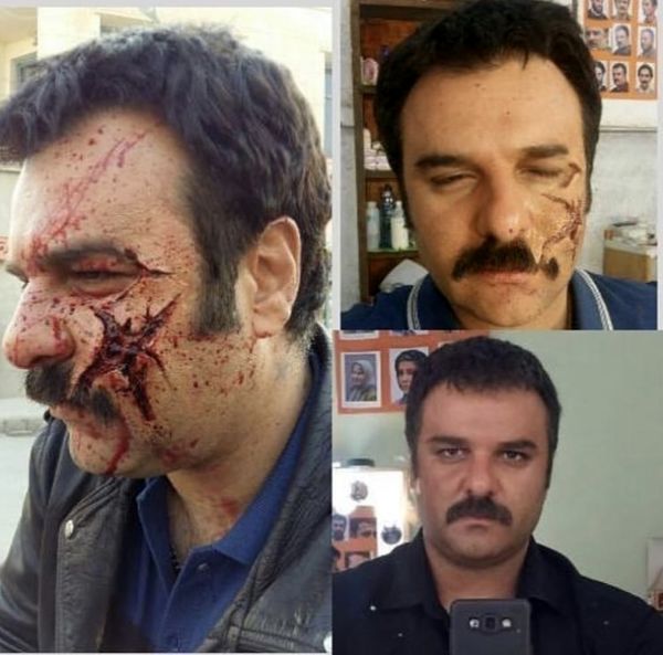 صورت مجید سعیدی ترکید + عکس