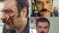 صورت مجید سعیدی ترکید + عکس