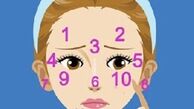 جوش زدن هر قسمت از صورت نشانه چیست؟ + روشهای درمان