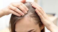 آیا شامپوهای ضد ریزش واقعاً از ریزش مو جلوگیری می کنند؟