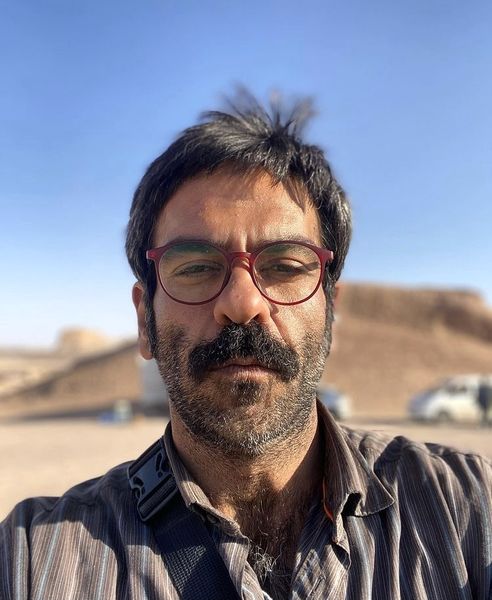 بازیگر سریال کرگدن تغییر چهره داد + عکس