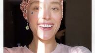 صورت آفتاب خورده بازیگر قورباغه + عکس