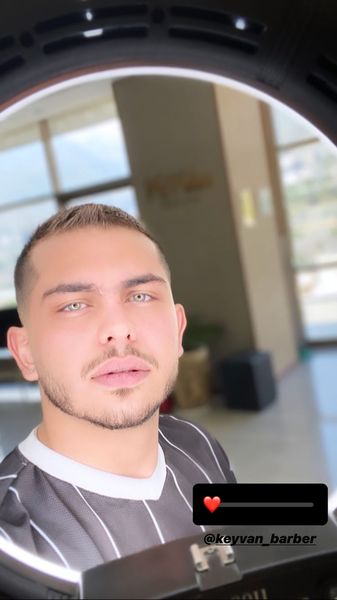 موهای ارسلان قاسمی چقدر کم بوده + عکس