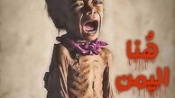  به زجر یمن پایان دهید