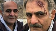 پیشونی زخم شده بازیگر فوق لیسانسه ها + عکس