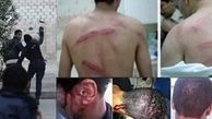 شکنجه زندانیان بحرینی توسط مزدوران بعثی