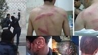 شکنجه زندانیان بحرینی توسط مزدوران بعثی