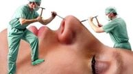 هشدار وزارت بهداشت درباره کلینیک‌های زیبایی غیرقانونی