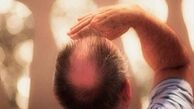 یک راه ساده برای حفظ موی سر