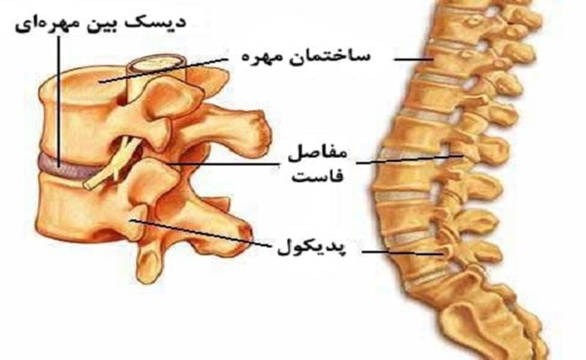 نشانه های دیسک کمر + جزئیات