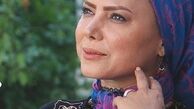 عکس خانم بازیگر بدون مو