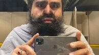عکس قبل و بعد عمل امیر نوری