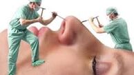 جراحی پلاستیک برای تغییر سرنوشت! +عکس