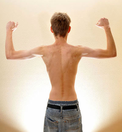 ترکیب این 2 میوه به سرعت لاغرتان می کند !