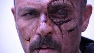 صورت ترکیده علیرضا کمالی + عکس