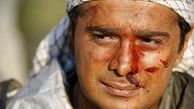 صورت زخمی سپند امیرسلیمانی + عکس