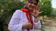 دستان خونی خانم مجری در طبیعت + عکس