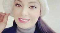 ظاهر این روزهای صبا راد پس از بازگشتش به ایران + عکس